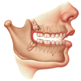 Demonstração de cirurgia dos dentes inclusos / dente do siso